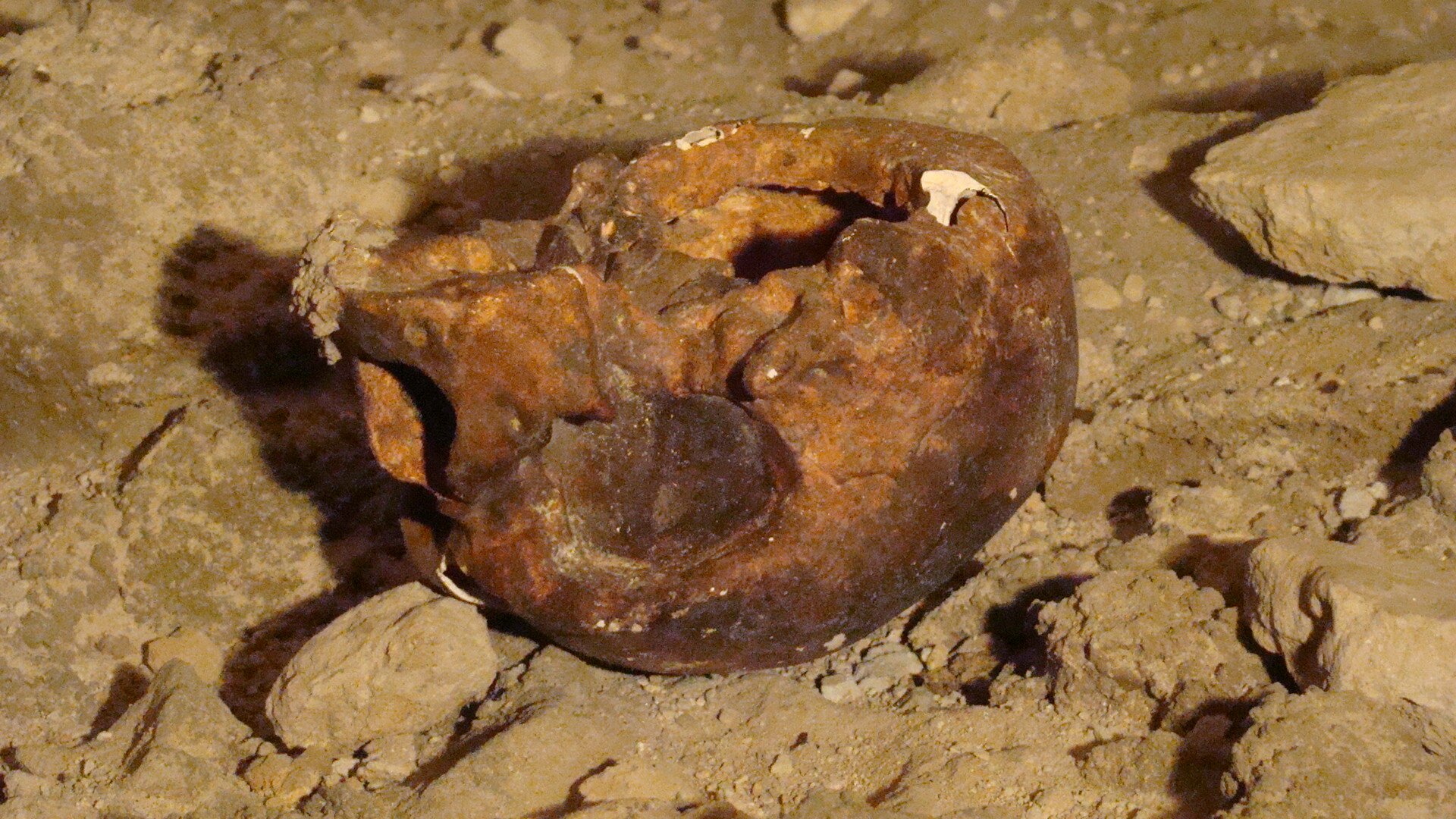 calotta cranica