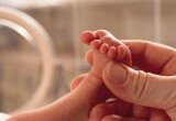 neonato